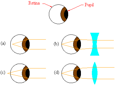 The eye and eyeglasses.